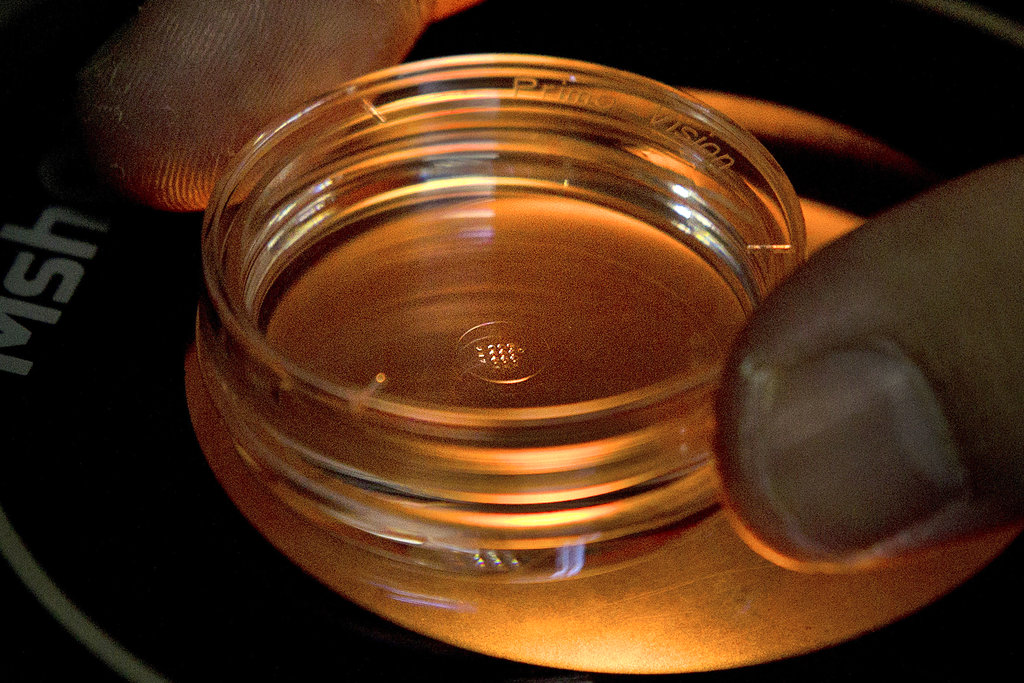 AP-NORC Poll: Edit baby genes for health, not smarts